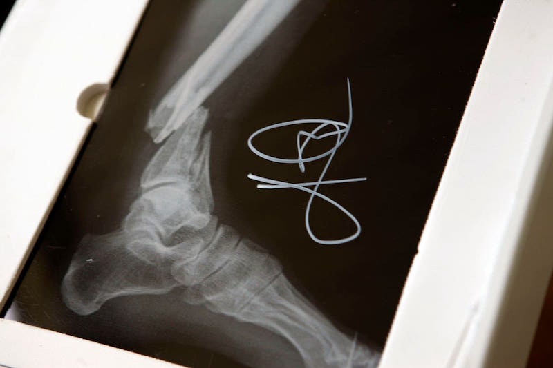 Nike, Kyrie 3  超限量套装!被称为 “晃断腿” 套装里面到底有什么? Nike, Kyrie 3  超限量套装!被称为 “晃断腿” 套装里面到底有什么?